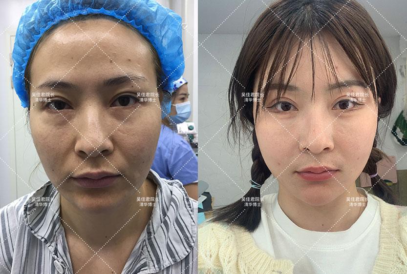 阿克苏_三肖三期必出三肖三码微博,扒皮示例代码请全面2释义、解释与落实